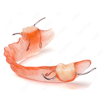 Acrylic Partial Dentures