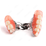 Acrylic Partial Dentures