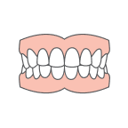 Full Dentures