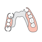 Partial Dentures