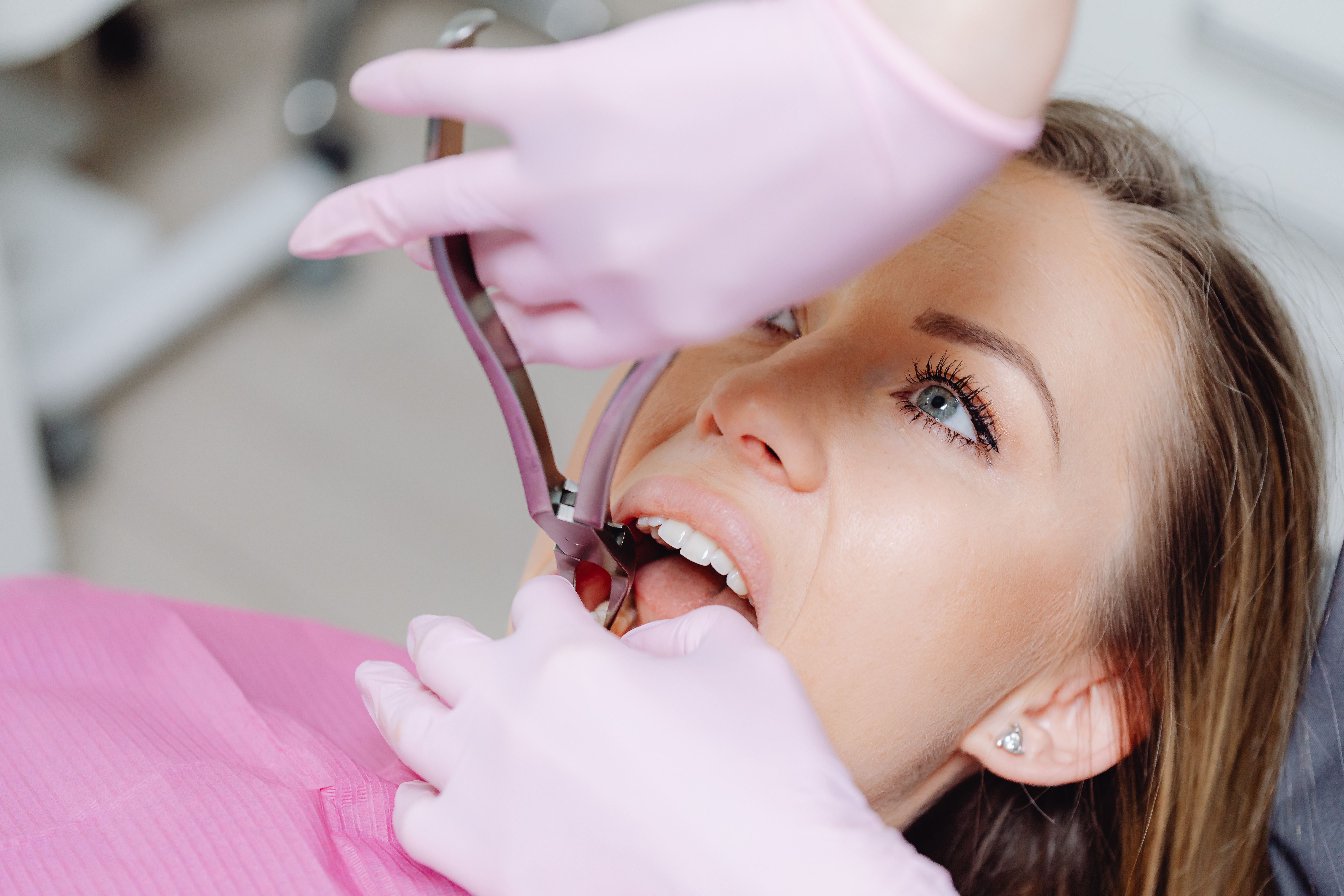 What to Expect If You Need Extractions Before Your Dentures Are Made