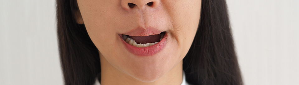 Woman with swollen jaw.