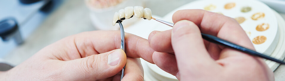 Tooth Replacement Options