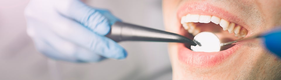 Worrying Sensations Following Dental Procedures