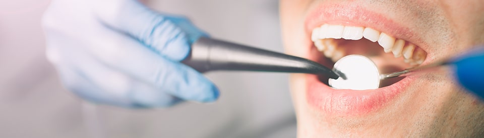 Same-day root canal Upper Darby Township