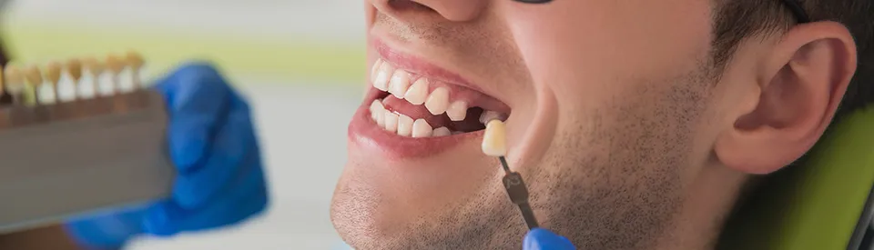 man with mouth open, missing tooth, with implant being compared