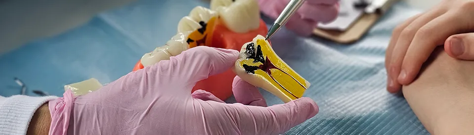 dentist using tooth disaply to show root