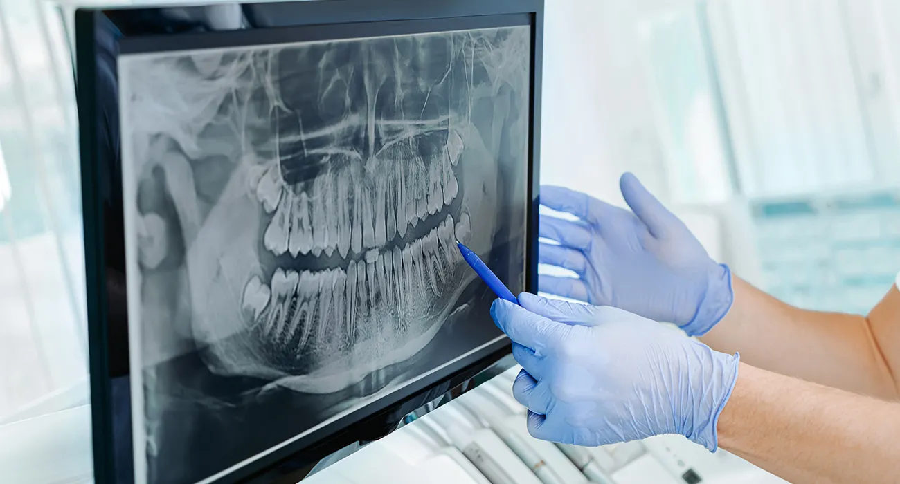 x-ray being examined by dentist