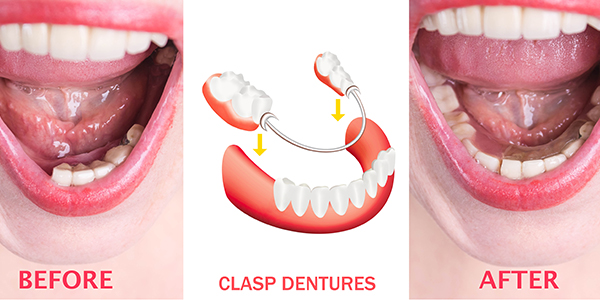 Dentures & Implants New Brighton, PA 15066 | Emergency