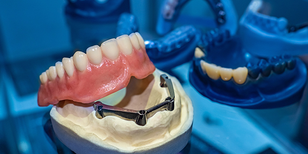 Dental Implants West Virginia