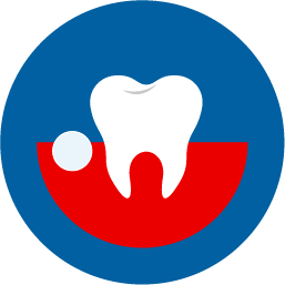 illustrated tooth abscess