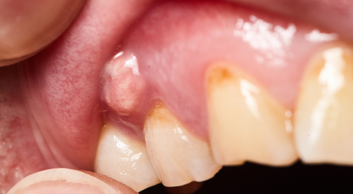 Emergency Dental