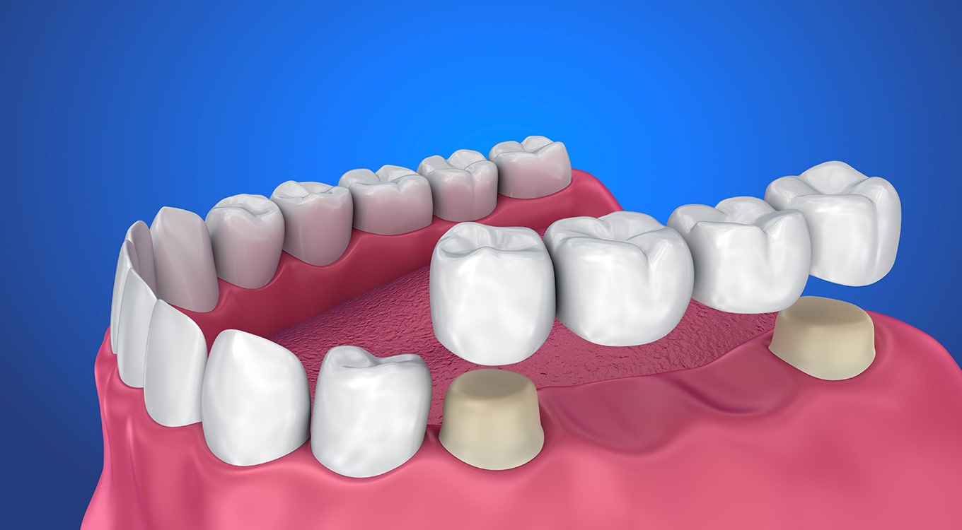 Dental Emergency