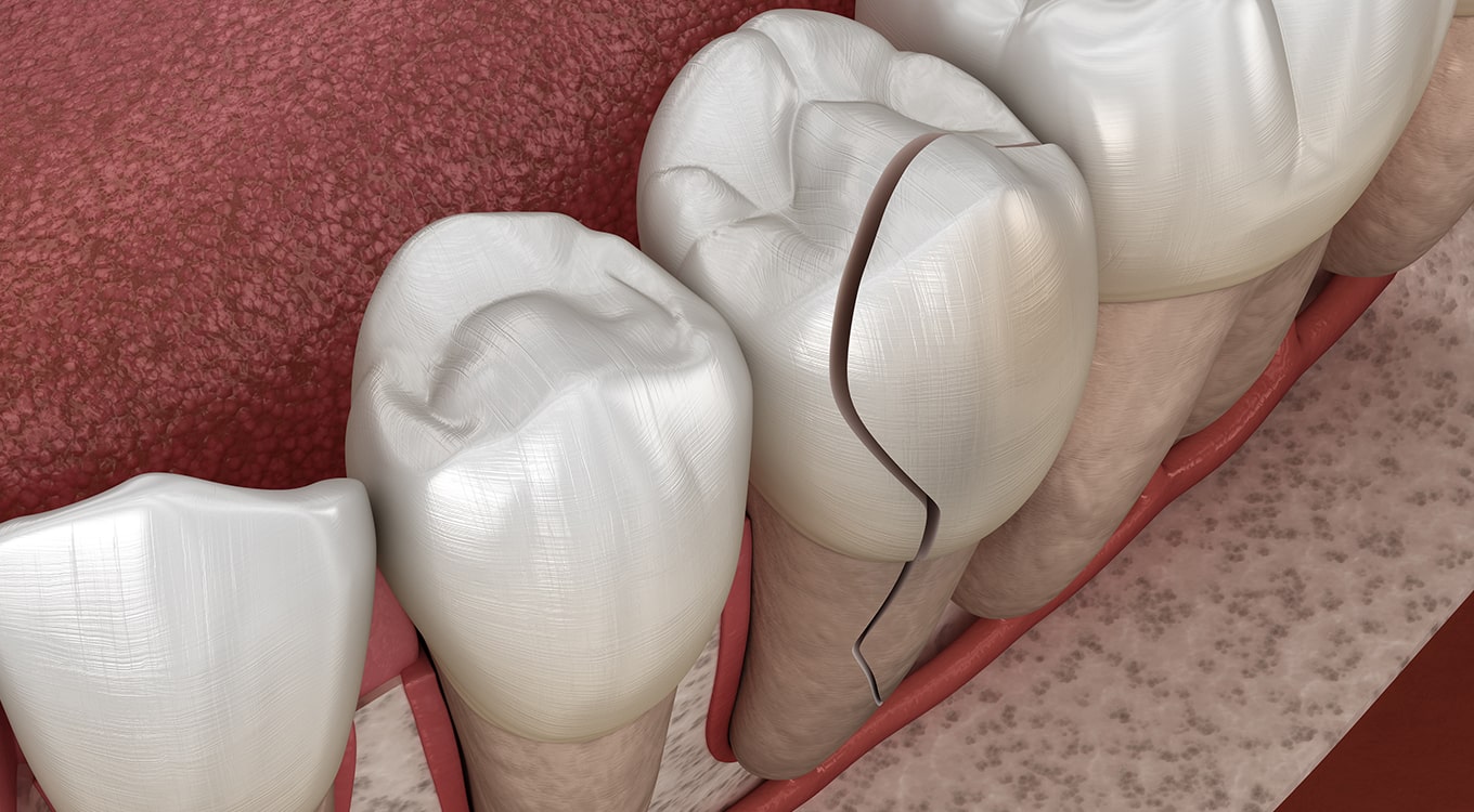 Emergency Dental Service