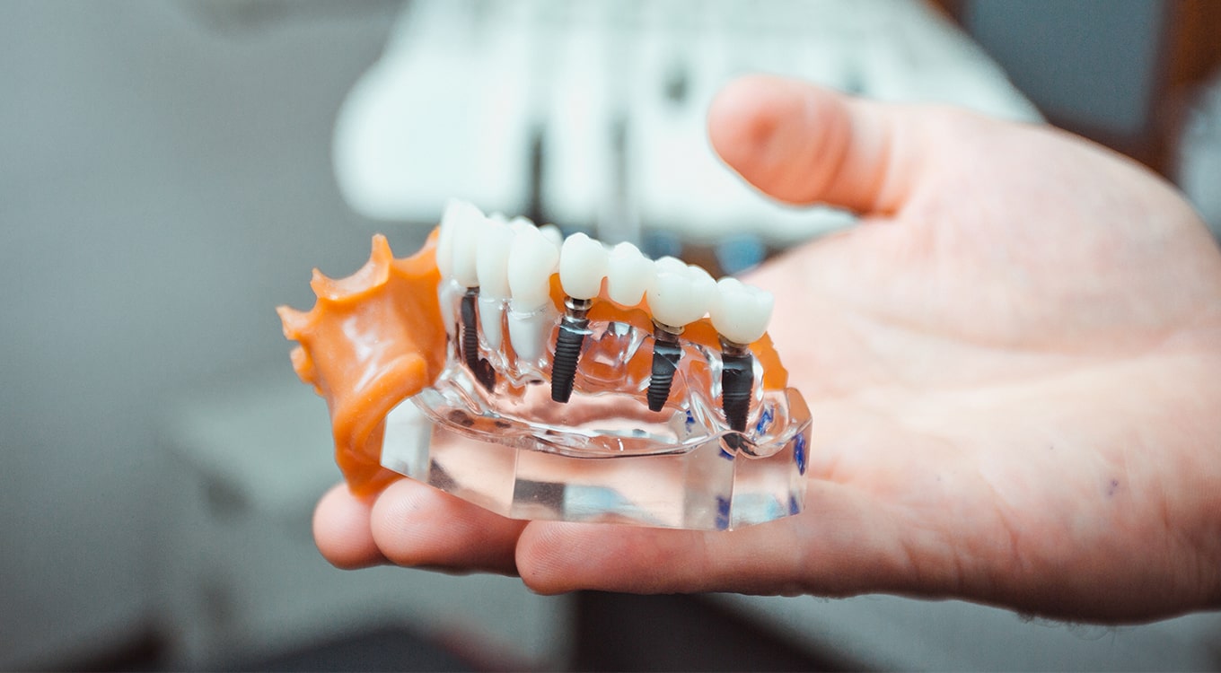 Emergency Dental Service