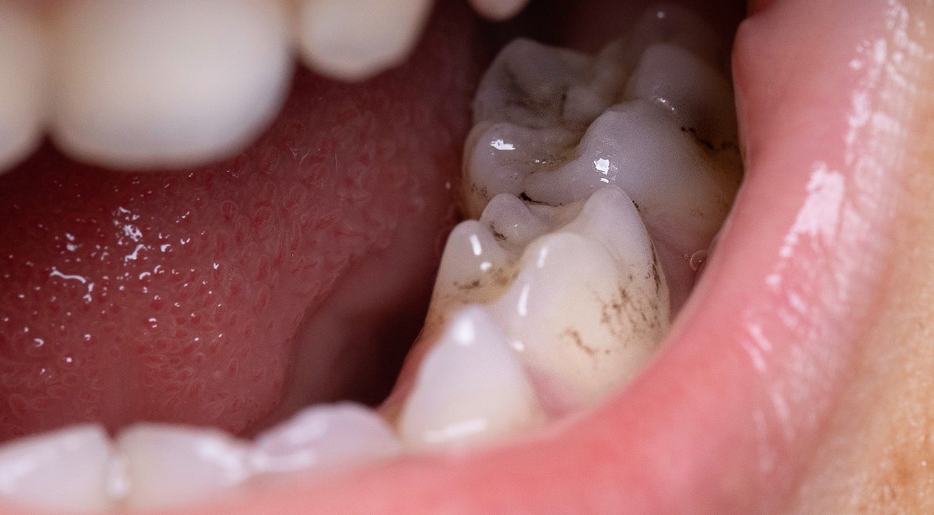 Emergency Dental Service