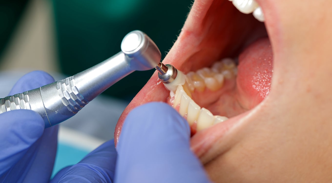 Emergency Dental Service